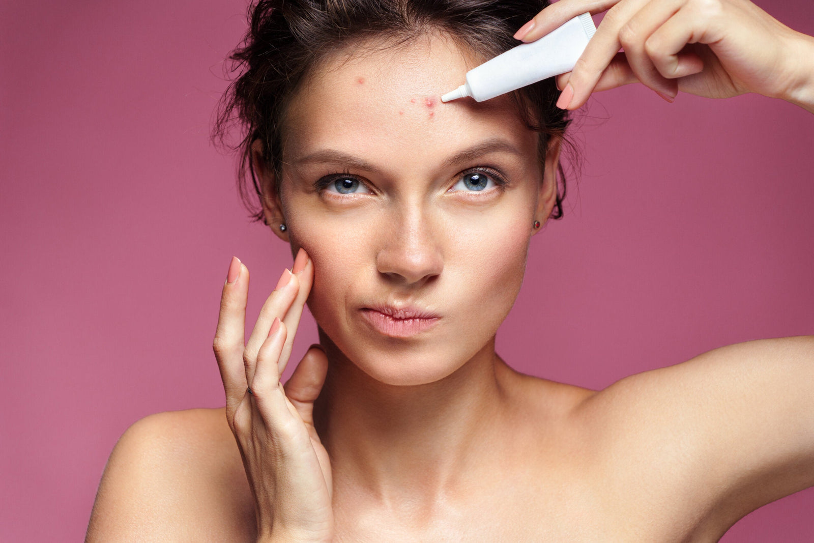 how to take care of your acne-prone skin?